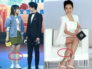 女明星小腿,揭秘女明星小腿的完美比例与保养秘诀